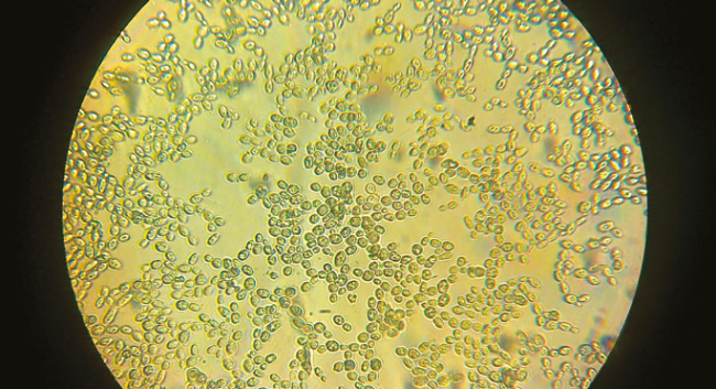 preview, Analytical services for the fermentation industry