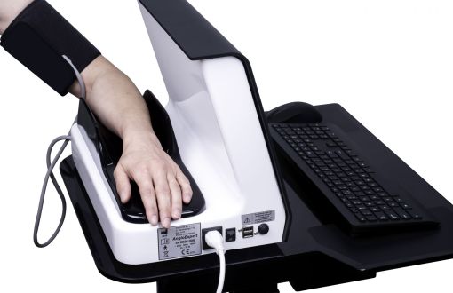 Urządzenie medyczne AngioExpert  fot. arch. Angionica